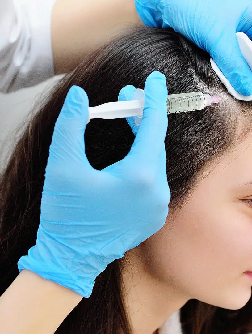 PRP with Biotin hair restoration treatment at Grace Follicles