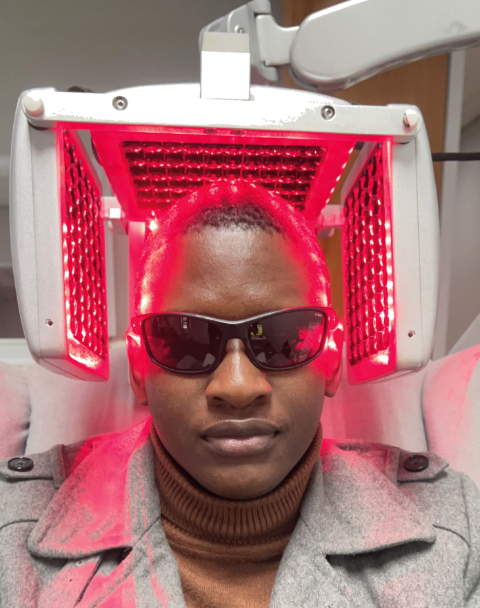 Low level laser therapy treatment for hair loss at Grace Follicles